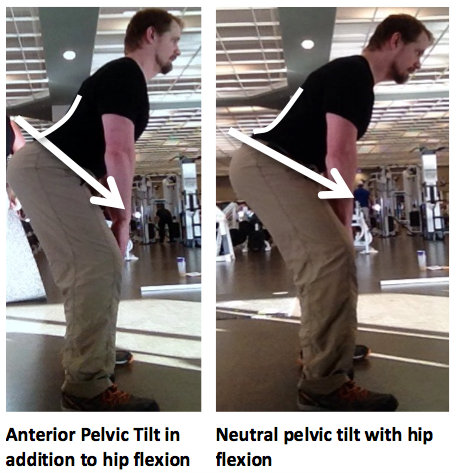Anterior tilt vs. neutral pelvis in hip hinge